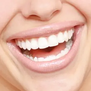 Teeth Whitening